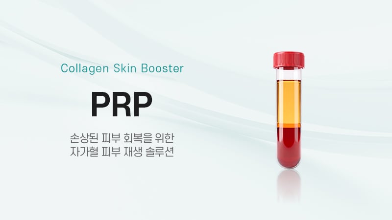 PRP
